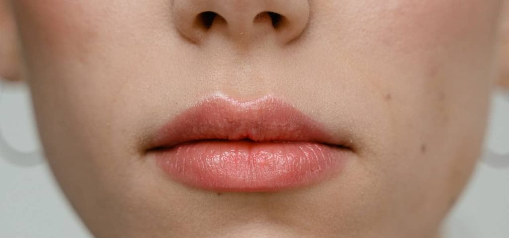 what is cause of dry lips