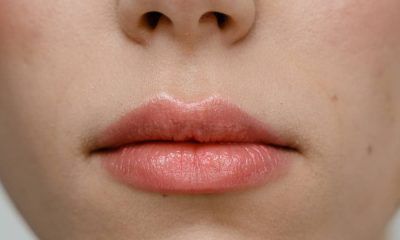 what is cause of dry lips