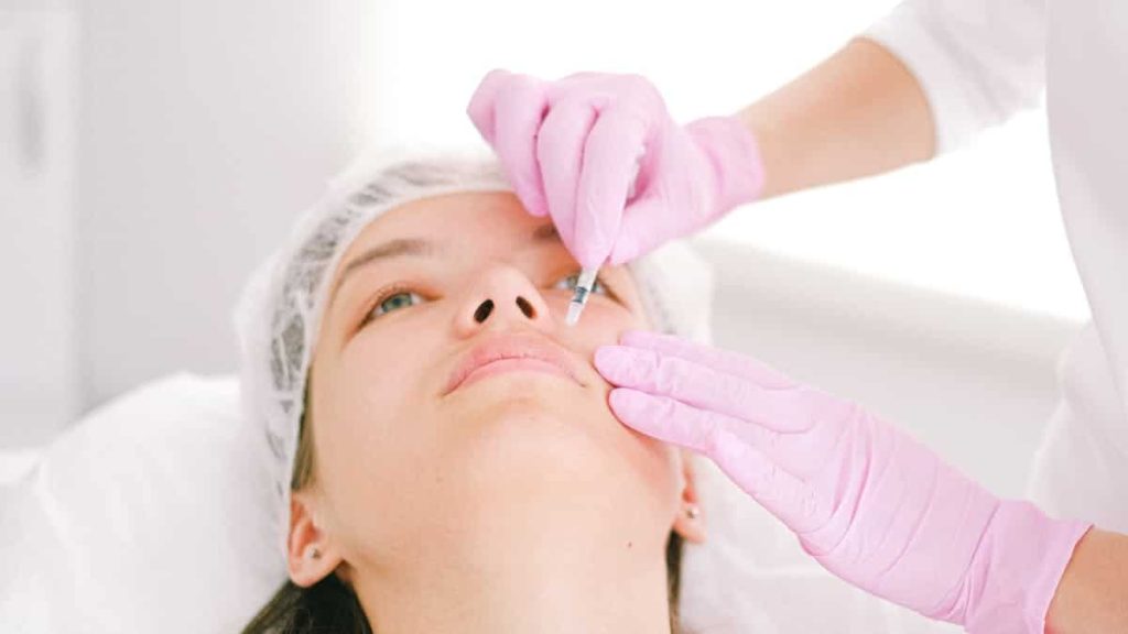 botox smile lift before after