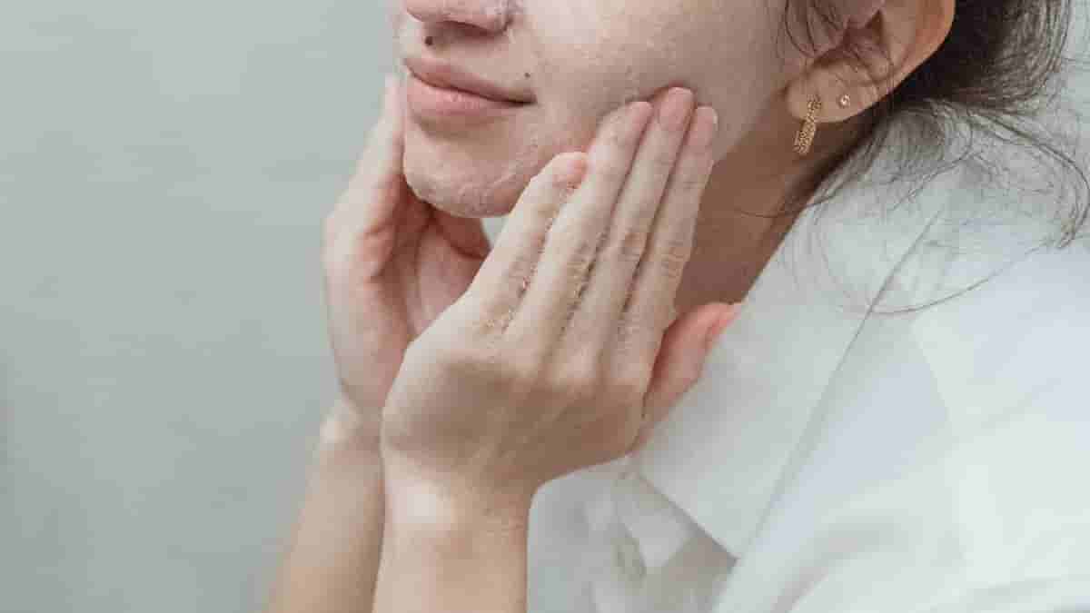 aloe vera and propolis cream