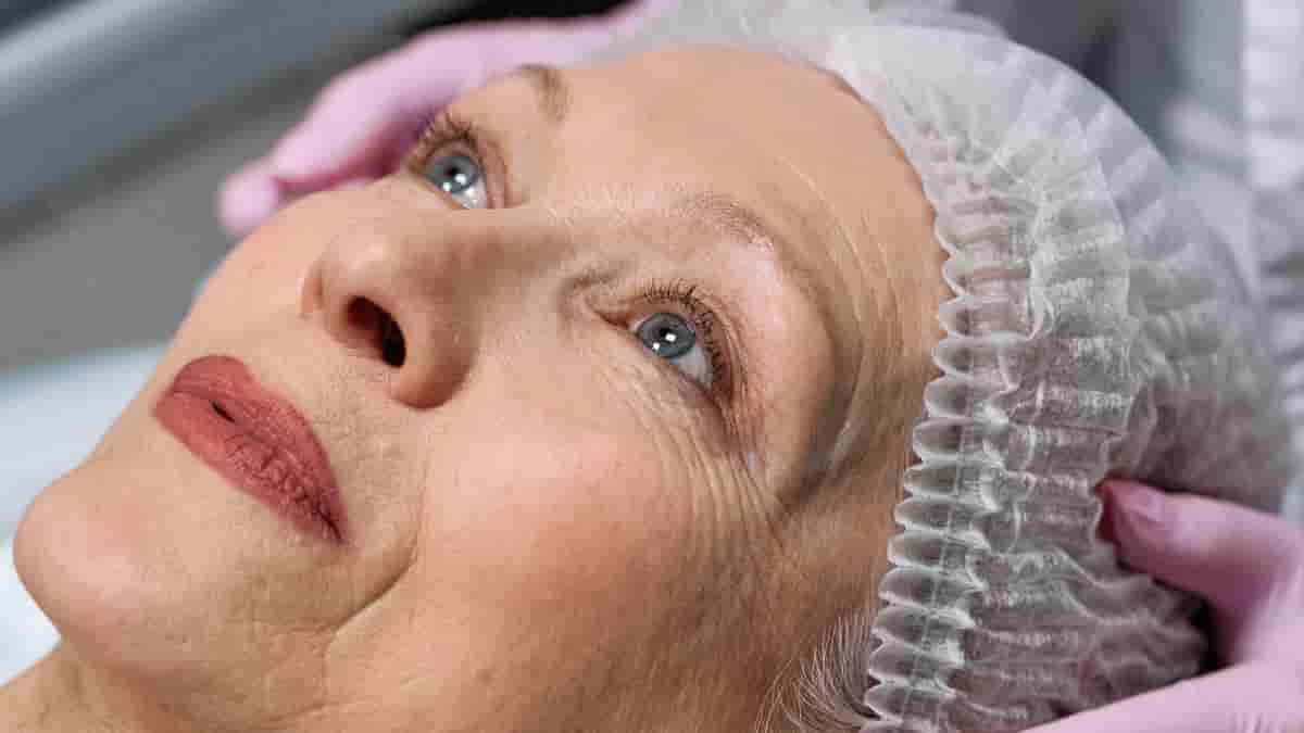 micro botox before after