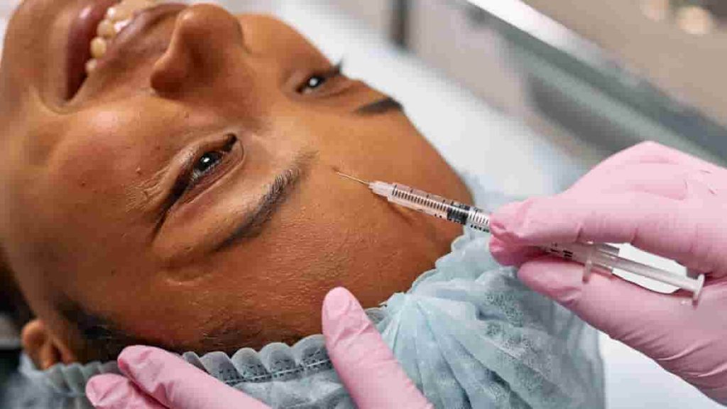 brow lift botox before after