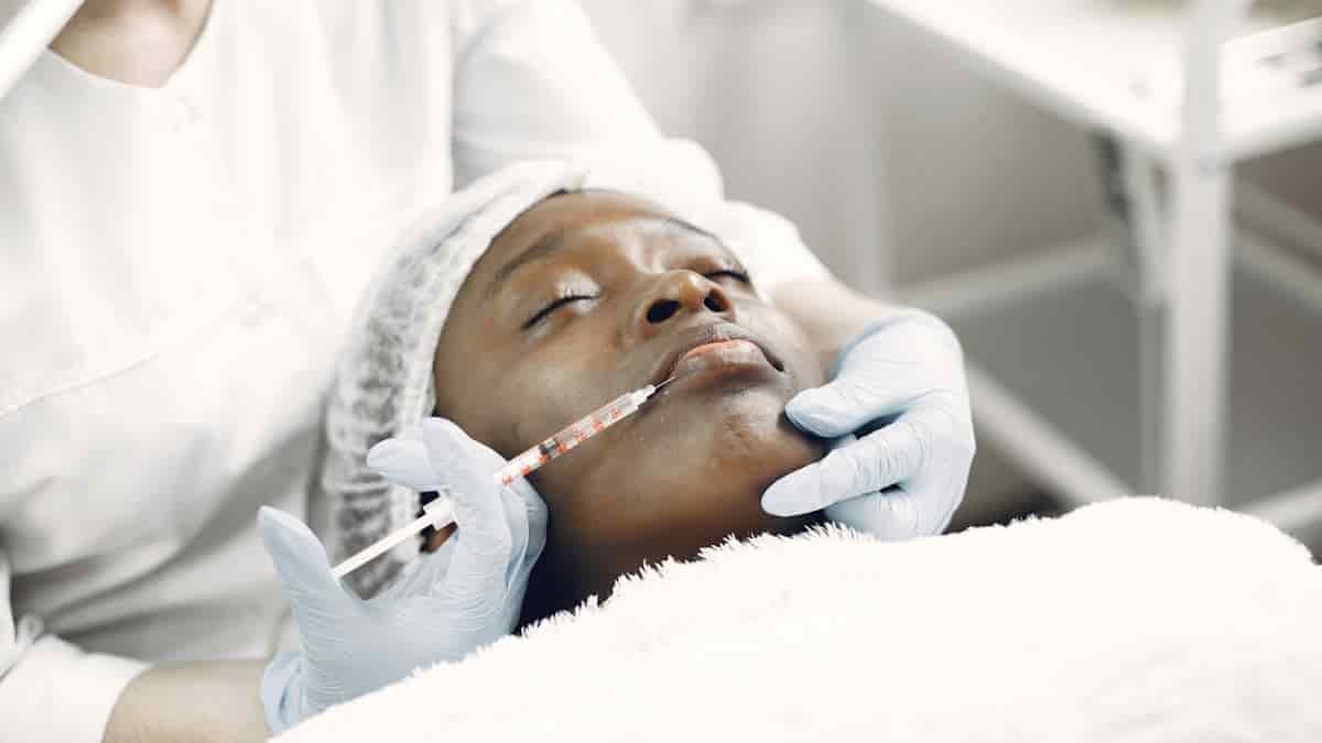 smile lift botox before and after