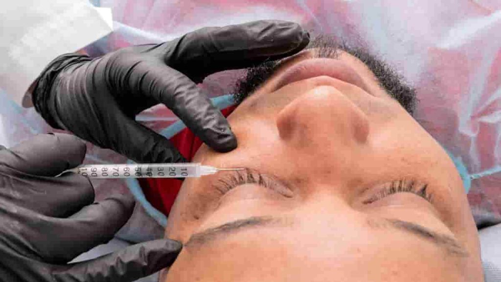 eye botox before and after