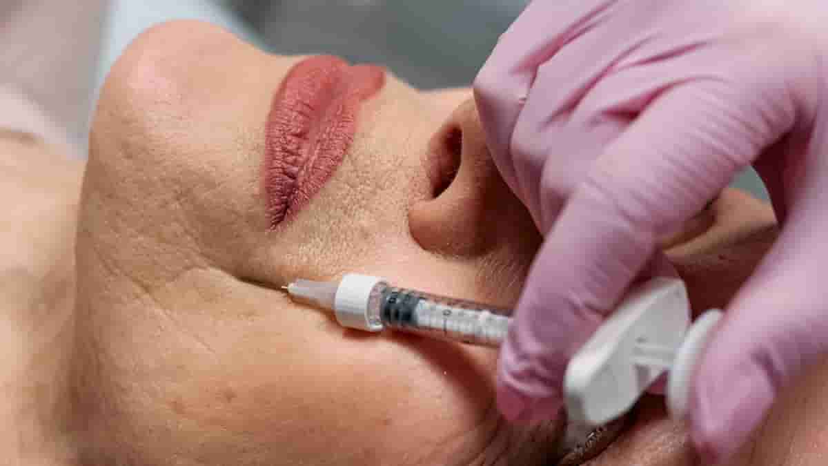 injectable fillers for the face before and after