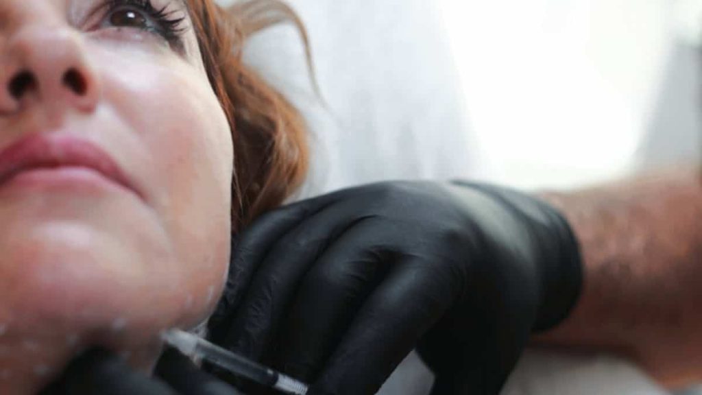 neck botox before and after