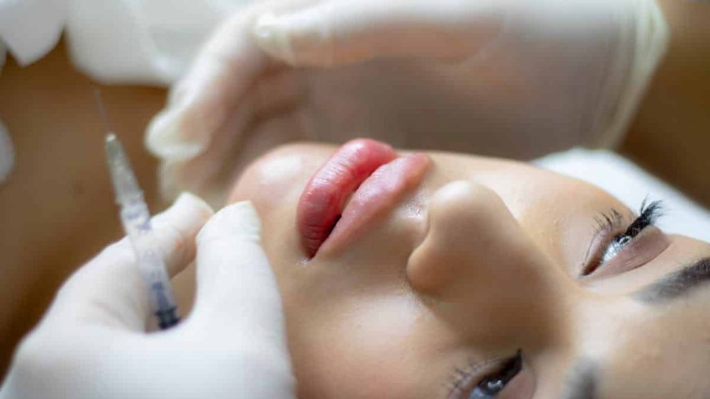 lip fillers vs injections