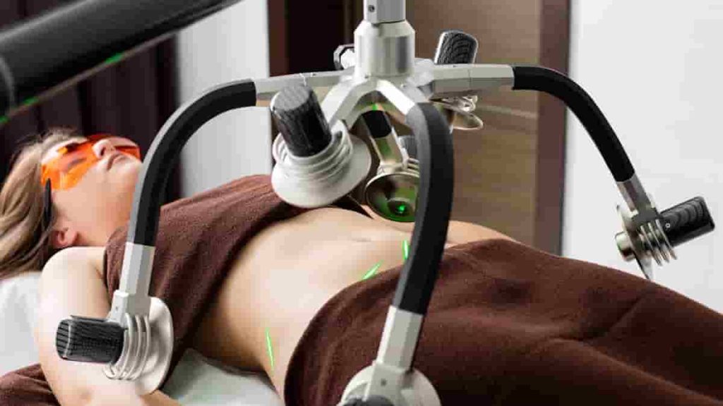 before and after laser lipo