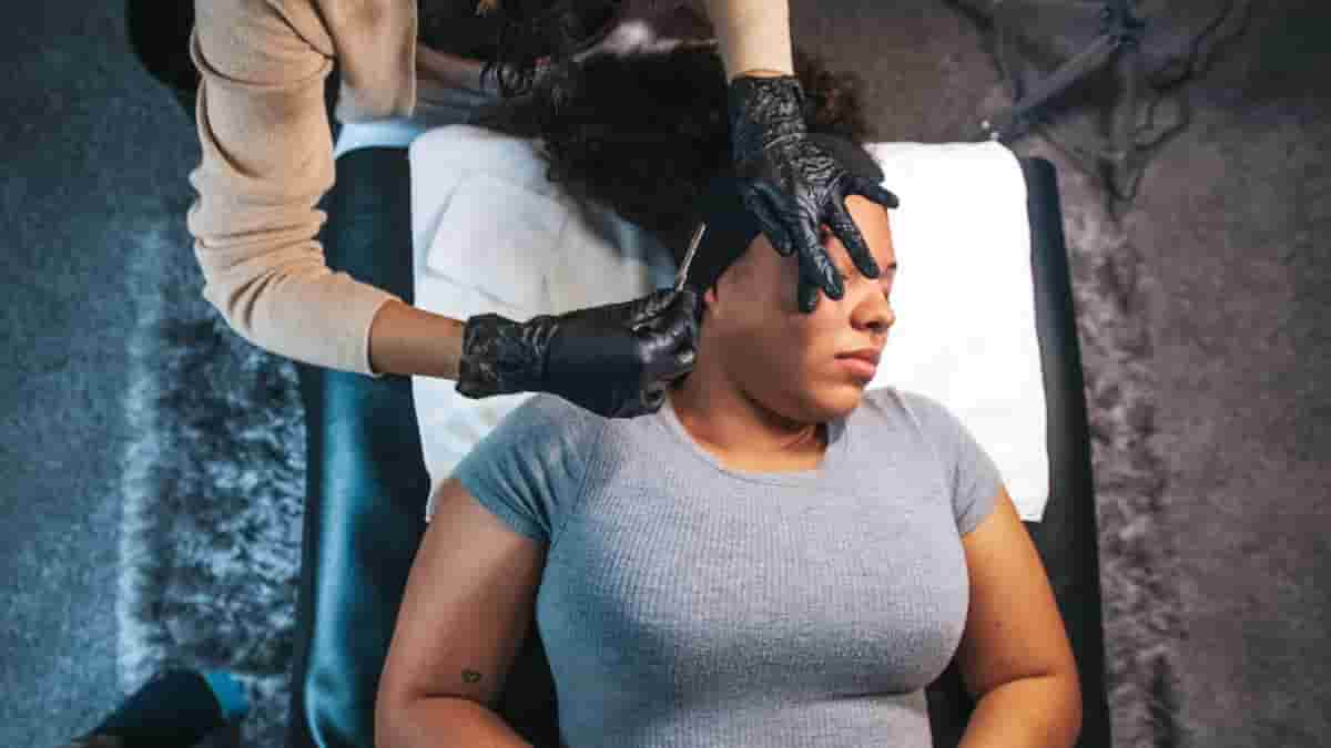 dermaplaning before after