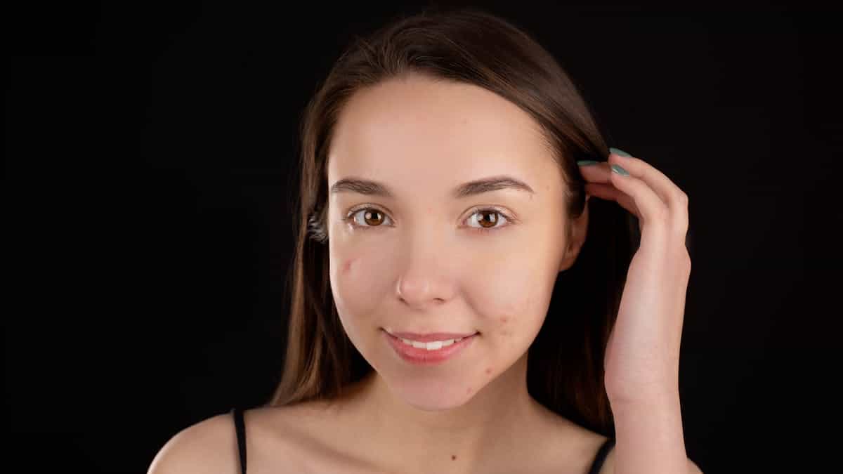 prp before and after face